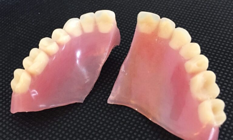 Bristol And Bath Denture Repairs in Staple Hill, Bristol